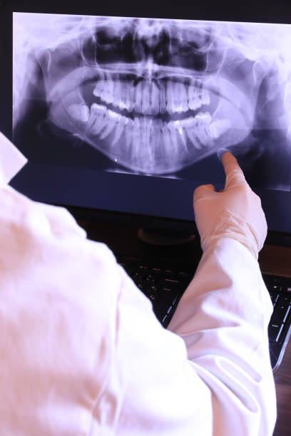 Best Emergency Tooth Extraction in Columbus, KS