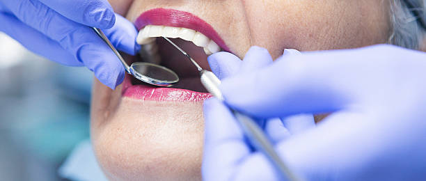 Best Emergency Treatment for Toothache in Columbus, KS